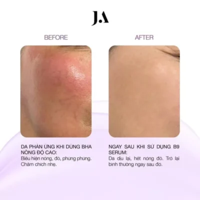 Serum B9 Dưỡng Ẩm, Phục Hồi Và Giảm Kích Ứng Da Juliette Armand Element Folic Acid B9 Serum - Ảnh 3